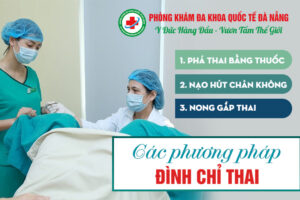 Các phương pháp phá thai