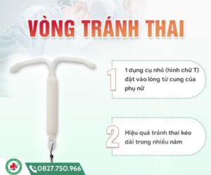 Thế nào là vòng tránh thai