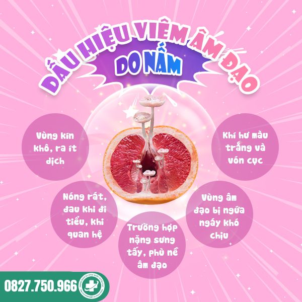 dấu hiệu nhiễm nấm âm đạo vùng kín